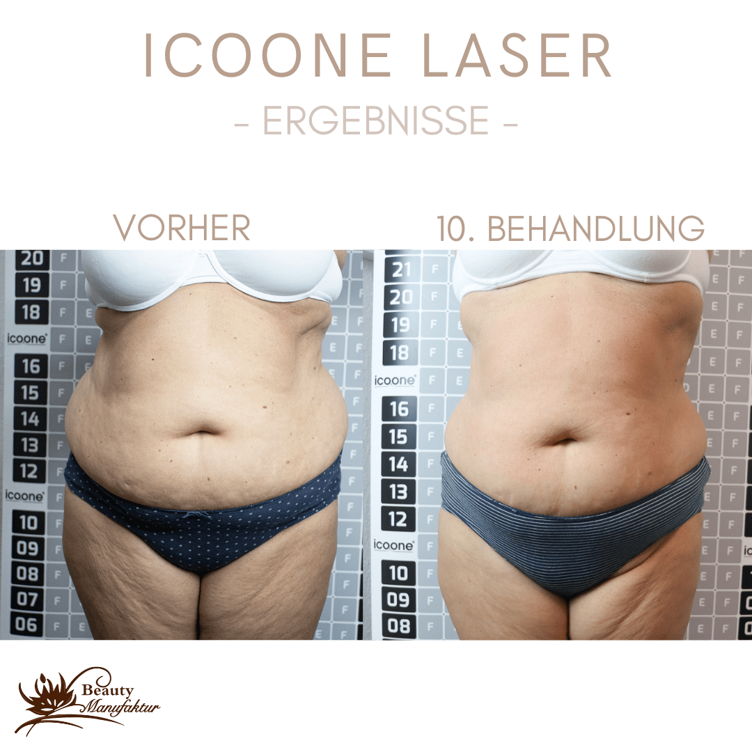 Icoone Ergebnisse-4