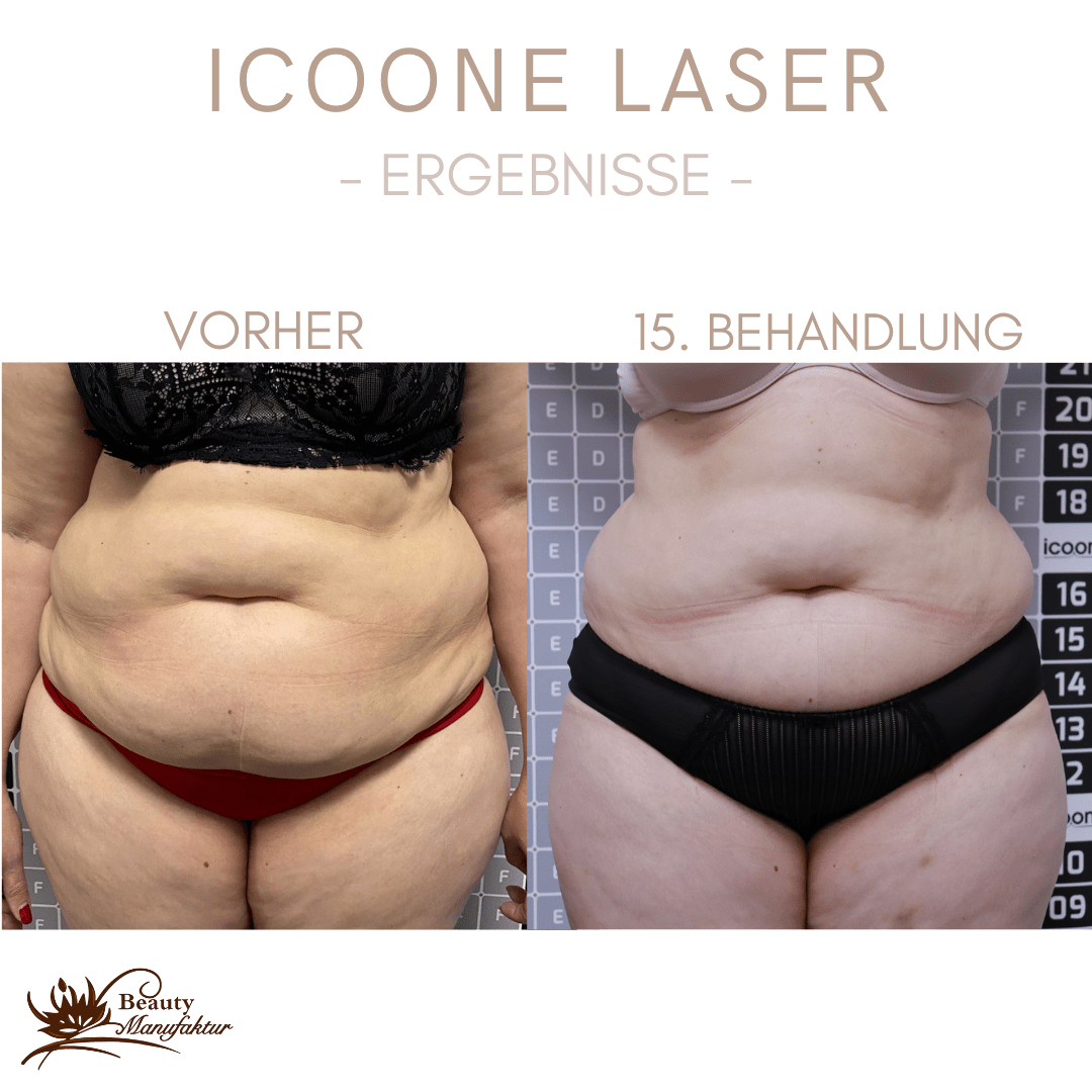 Icoone Ergebnisse-5 2